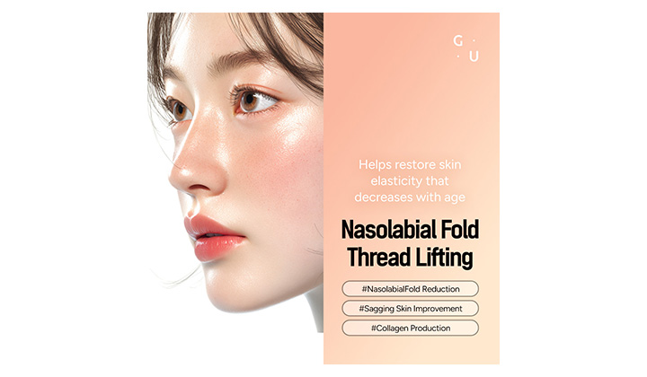 Thread Lifting in Gangnam for Nasolabial Folds