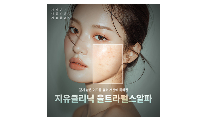 강남역피부과 여드름흉터 패임 레이저 전 놓치면 안될 부분