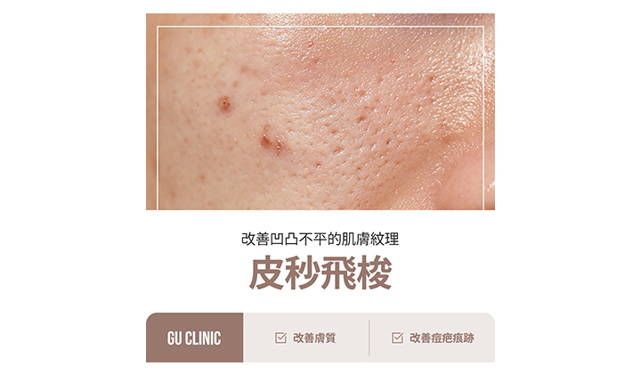 江南皮秒飛梭,真的能有效改善斑點、毛孔嗎?