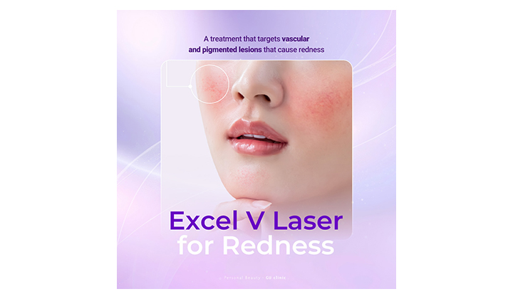 Gangnam redness laser for recurring flushing