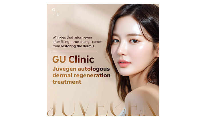 Juvegen for wrinkle improvement without volume