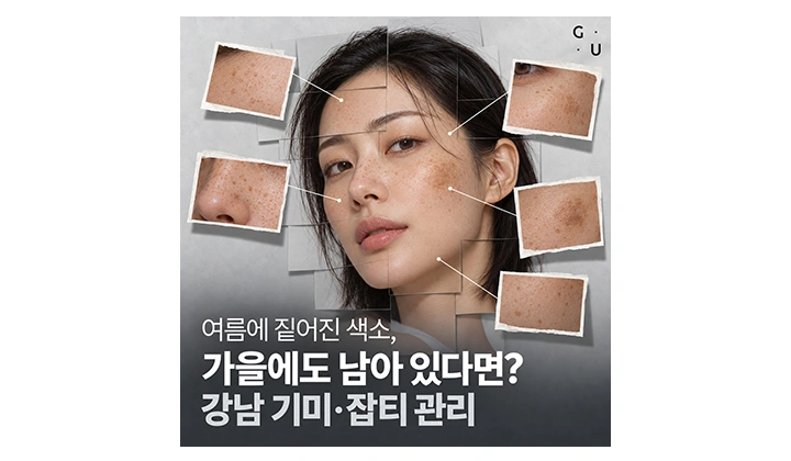 강남 기미 잡티 제거, 여름에 짙어진 색소가 가을에도 남아 있다면?