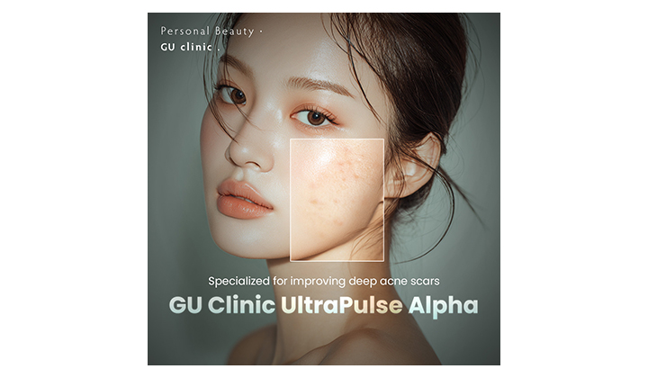 Key to know Gangnam acne scar laser treatment