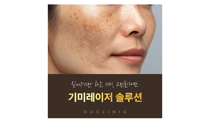 가려도 짙어지는 색소, 기미잡티제거 방법