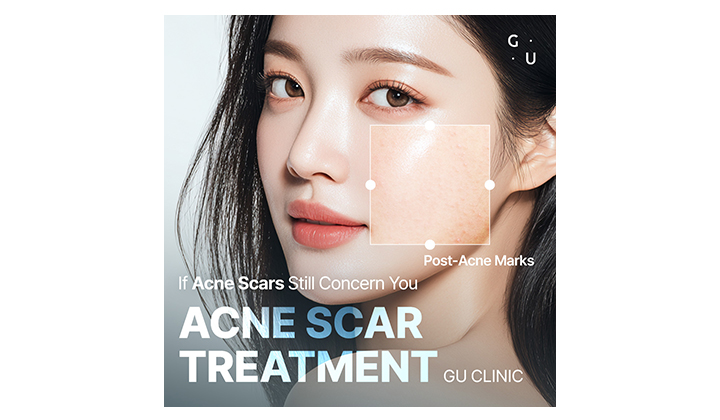 Juvgen Scar Treatment: Why Personalization Matters