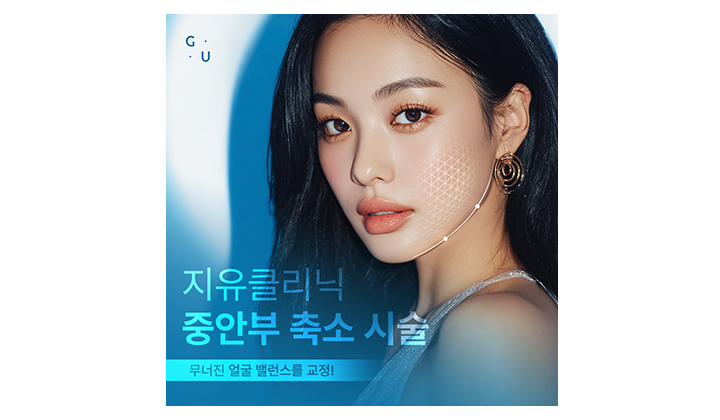퍼진 중안부 라인 바꿔놓는 신논현역 중안부 축소 시술