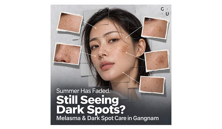 Korean Glass Skin Laser: Pico Laser for Hyperpigmentation That Lingers After Summer