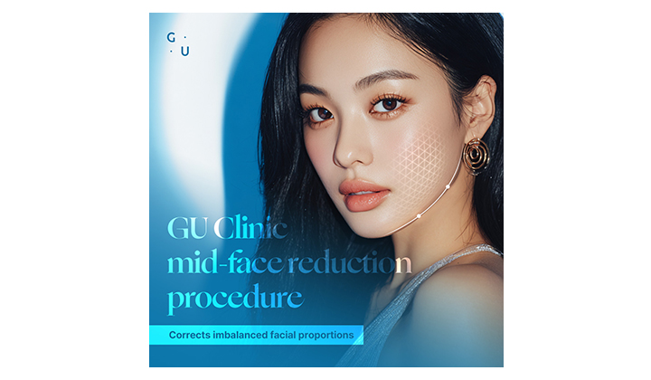 Sinnonhyeon midface reduction