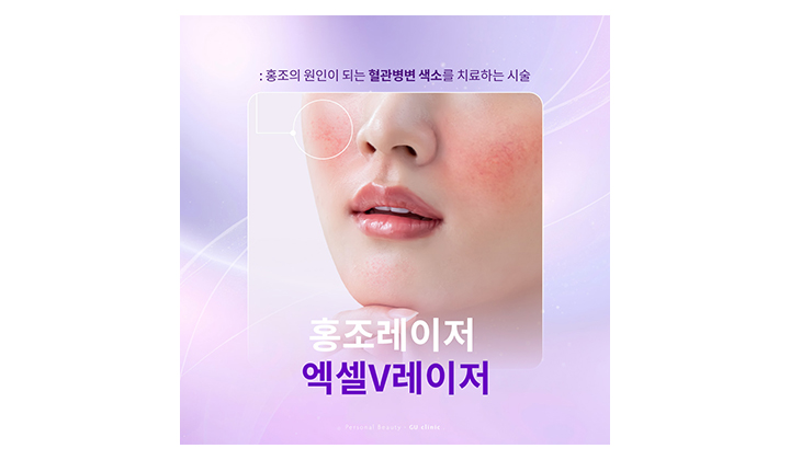 반복되는 홍조를 해결하는 강남역홍조레이저