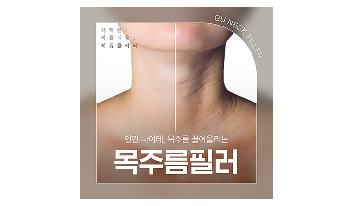 목선을 매끈하게 만드는 목주름필러