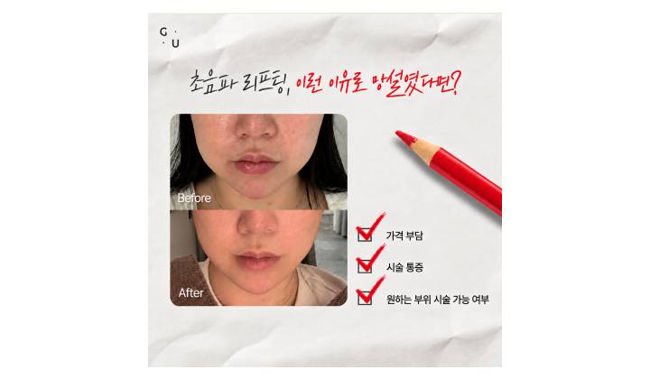 서울 울트라인 리프팅, 얼굴과 바디를 함께 관리할 수 있을까요?