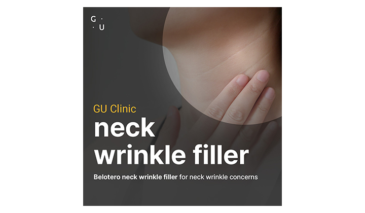 Neck wrinkles? Belotero neck filler